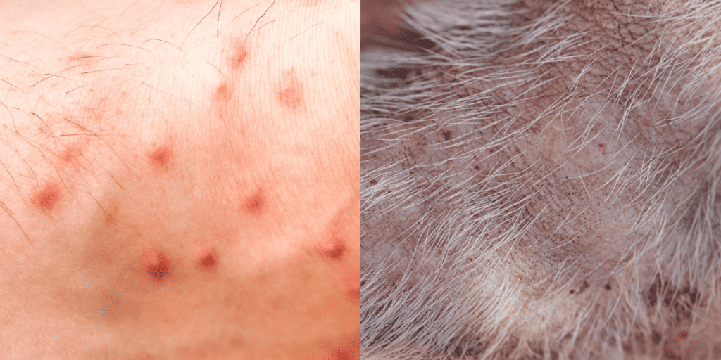 flea bite on human skin vs dog