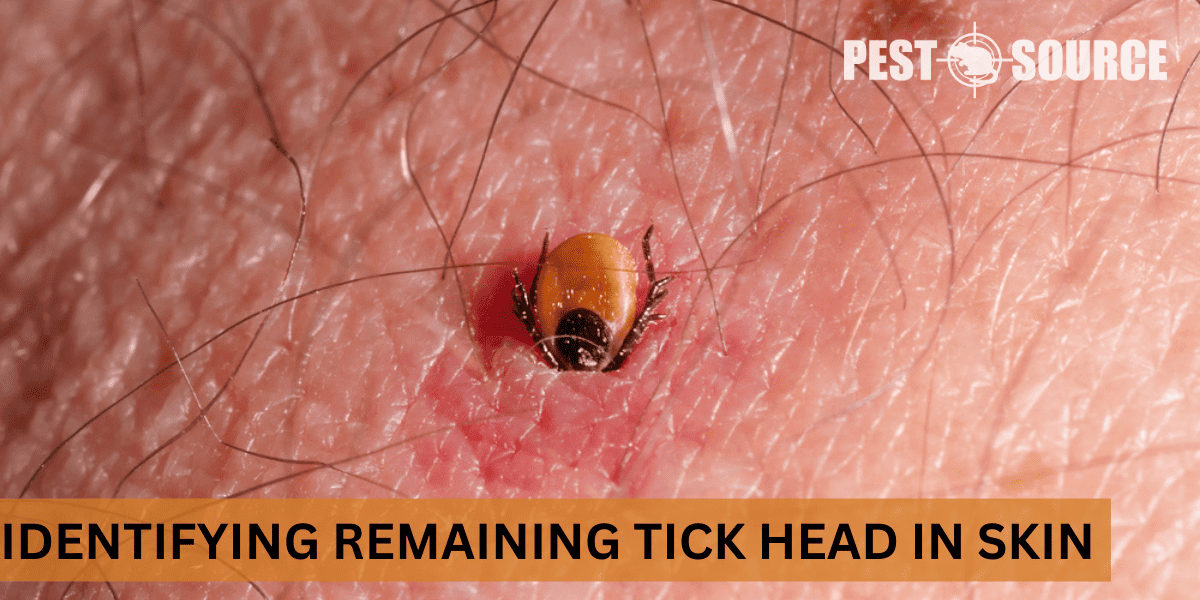 Head of tick
